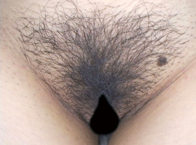 GA-299